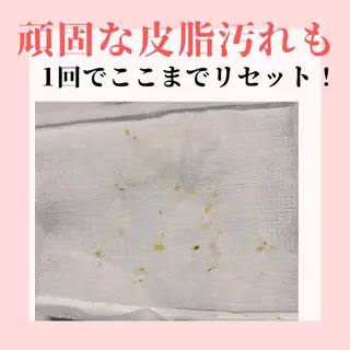 ピーリング専門店 Belluteのエステ・リラクイメージ