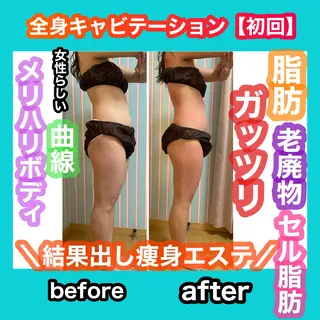 痩身/脱毛/ネイル HARUKAのエステ・リラクイメージ