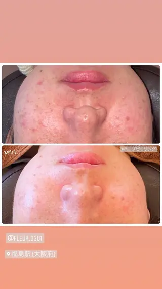 FLEUR大阪・整体 ・ハイフ・痩身・小顔のエステ・リラクイメージ