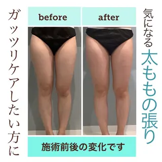 エステサロン JURISのエステ・リラクイメージ