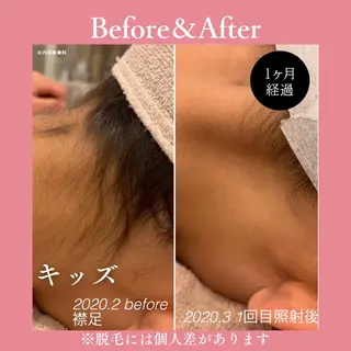 メンズ キッズ 有人型セルフサロン 脱毛/痩身/美顔のその他イメージ