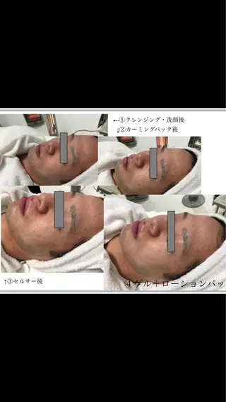 Lien オーナー 山口智嘉のエステ・リラクイメージ