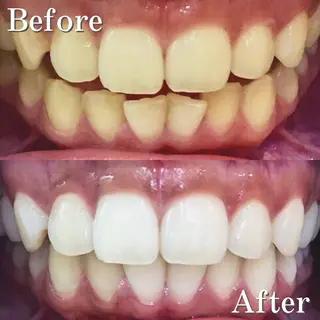 セミロング パーマ カラー メンズ ヘアアレンジ ネイル マツエク・マツパ アイブロウ LBSホワイトニング 銀座店💎店長浦和のその他イメージ