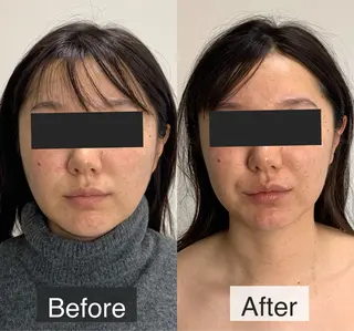 脱毛専門サロン BELFINE恵比寿のエステ・リラクイメージ