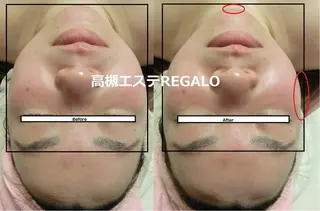 REGALO所属・矢野 さやかのエステ・リラクイメージ