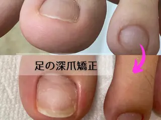 ネイル No&33所属・No&33 nail salonのエステ・リラクイメージ