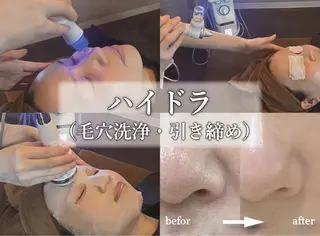 肌質改善専門 ハーブ /毛穴洗浄 リエイトのエステ・リラクイメージ