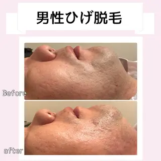 メンズ タマンサリ所属・タマンサリ 黒木のエステ・リラクイメージ
