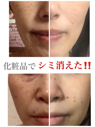 private salon  Dea_maris シュガーリング＆パーソナルボディケア所属・グランプリ受賞👑肌 体も別人級に変えるのその他イメージ