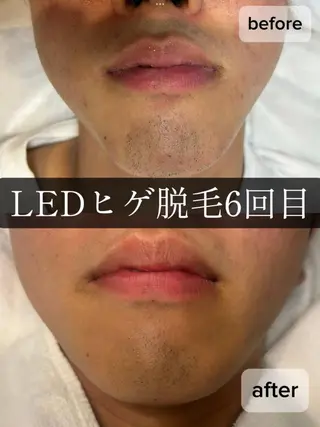 脱毛・眉毛・フェイス サロンN久留米店のその他イメージ