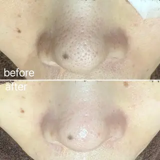 岩本 麻那のマツエク・マツパデザイン