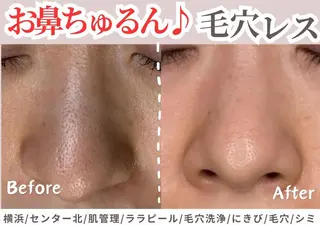 sii センター北 AIのエステ・リラクイメージ