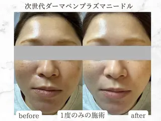 Rairy所属・Rairy Salon富士見町のエステ・リラクイメージ