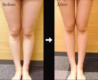 QANAEL所属・QANAEL 小山のエステ・リラクイメージ