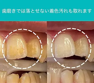 Retreatリトリート所属・歯科医院提携 Retreatのその他イメージ