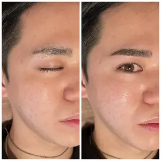 アイブロウ B&H所属・頭痛•肩こり専門/ 眉サロンB&H心斎橋のエステ・リラクイメージ