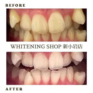 メンズ ホワイトニング ショップ新小岩店のその他イメージ