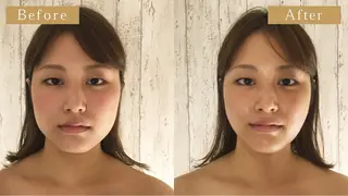 小顔・耳つぼ/ CHISATOのエステ・リラクイメージ