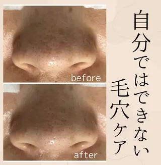 小顔・毛穴・たるみ ネイル　　似内真樹のエステ・リラクイメージ