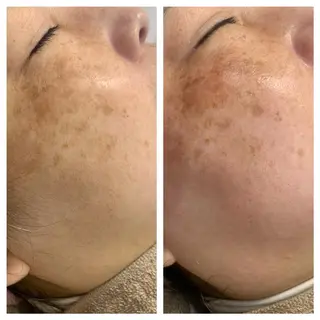 lafleur Yurinaのエステ・リラクイメージ