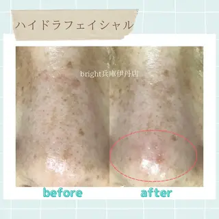 メンズ お手軽ホワイトニングsalon mina所属・武元 奈津美のエステ・リラクイメージ
