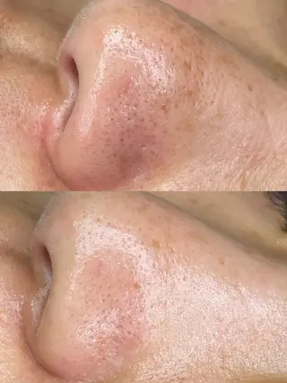 HOME所属・MA ORIの眉毛・アイブロウイメージ