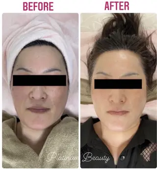 プラティーヌ ボーテ【もものり】のその他イメージ