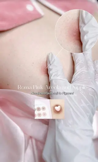 小顔/たるみ/黒ずみ除去専門サロン/SONA 大和西大寺店所属・【小顔専門看護師 サロンSONA】のエステ・リラクイメージ