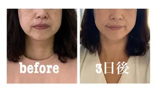 小顔と ヘッドスパのお店のエステ・リラクイメージ