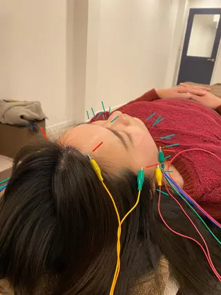 美容鍼灸Solana所属・肌質改善×美容鍼 ゆいのエステ・リラクイメージ