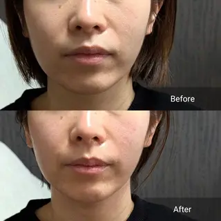 nail RiRi アトレナチュラのエステ・リラクイメージ