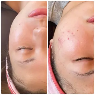 FLEUR大阪・整体 ・ハイフ・痩身・小顔のエステ・リラクイメージ