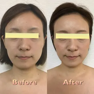 小顔筋膜矯正サロン桜Biscuit~サクラビスケット~所属・桜Biscuit 〜サクラビスケット〜のエステ・リラクイメージ