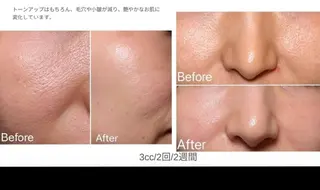 ナスサロ️ 看護師️🫧山口のエステ・リラクイメージ