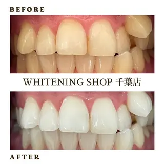 メンズ ホワイトニング ショップ千葉店のその他イメージ