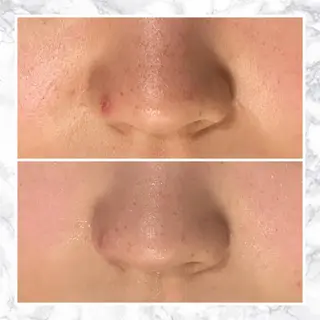 ミディアム カラー パーマ ヘアアレンジ メンズ キッズ ネイル マツエク・マツパ アイブロウ 触れたくなる モテ肌へ...❤︎のエステ・リラクイメージ