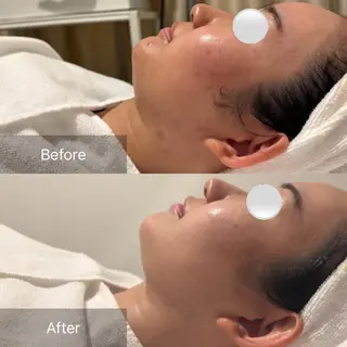 【美肌・脱毛専門店】 SARA 恵比寿店のエステ・リラクイメージ