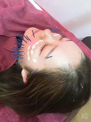 美容鍼灸女性専用 りんご鍼灸治療院のその他イメージ