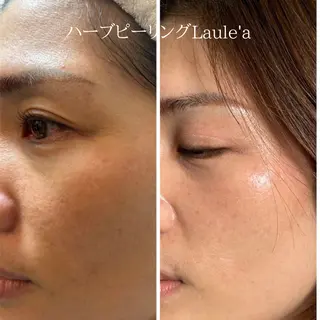 痩身/腸もみ/ ヘッドスパ/リンパのエステ・リラクイメージ