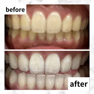 LBSホワイトニング 🌐渋谷店 河内のエステ・リラクイメージ