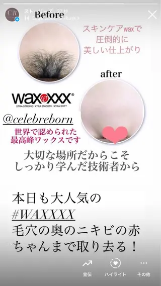 セレブリボーンパッシブタウン　プレミア所属・目澤 幸代のエステ・リラクイメージ