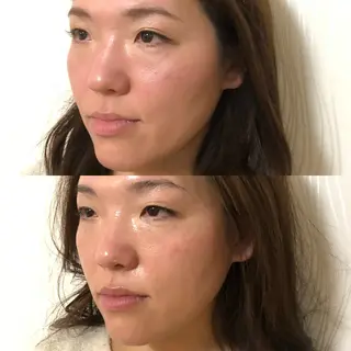 毛穴シミケア専門店aloha malie所属・水野 彩のエステ・リラクイメージ