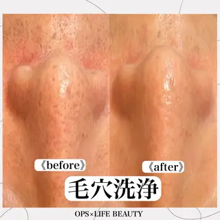 メンズ OPS×LIFE BEAUTY所属・OPS×LIFE BEAUTY/maiのエステ・リラクイメージ