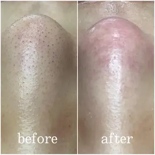 枝廣 貴子のエステ・リラクイメージ