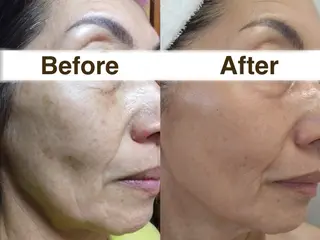 つや肌スペシャリスト 田中美沙のエステ・リラクイメージ