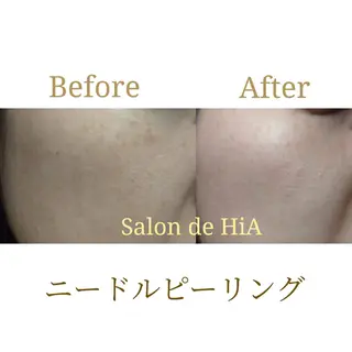 Salon de HiAのエステ・リラクイメージ