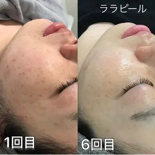 天神　MeMe エステ屋のエステ・リラクイメージ
