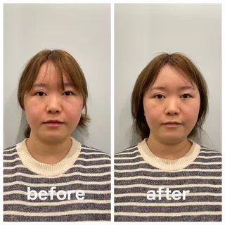 美容整体 小顔矯正 プラスフィール荒木のエステ・リラクイメージ