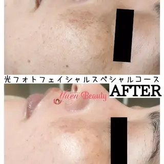 癒縁所属・美肌ハーブピーリング ゆえん　ｒｉｅ🌈のエステ・リラクイメージ