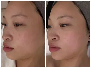 アピタ千代田橋店 POLA THE BEAUTY所属・エステ ツヤ肌 マッサージ POLAのエステ・リラクイメージ